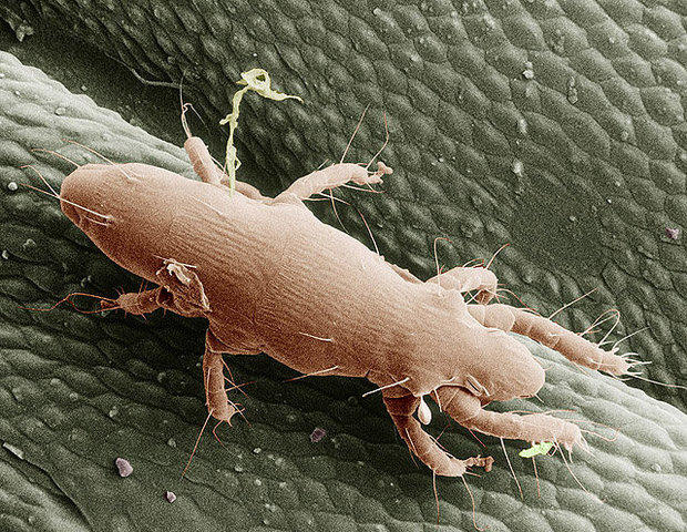 Oak Mites Are Back With A Vengeance In Kansas City | KCUR