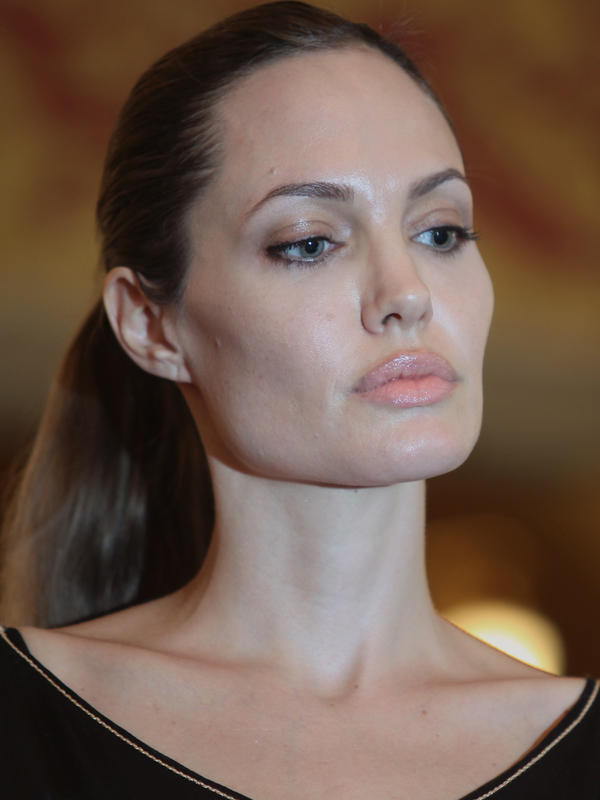 Angelina Jolies Mastectomy Decision And Weighing Cancer Risks Health