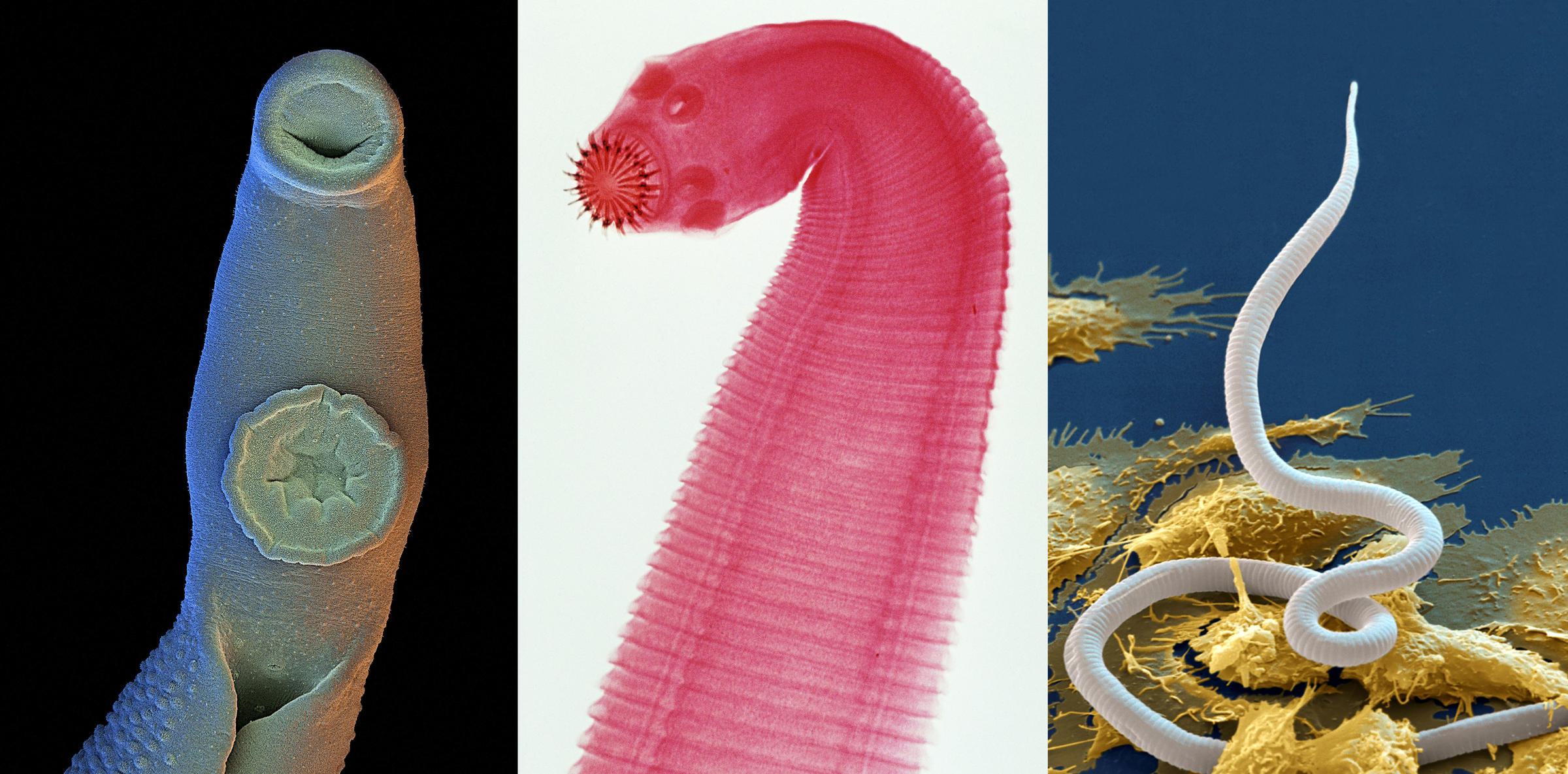 types of intestinal flat worms