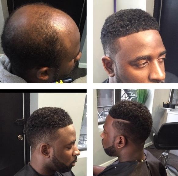 Man Weaves Offer Cover For Balding Men Cash For Black Hair Care