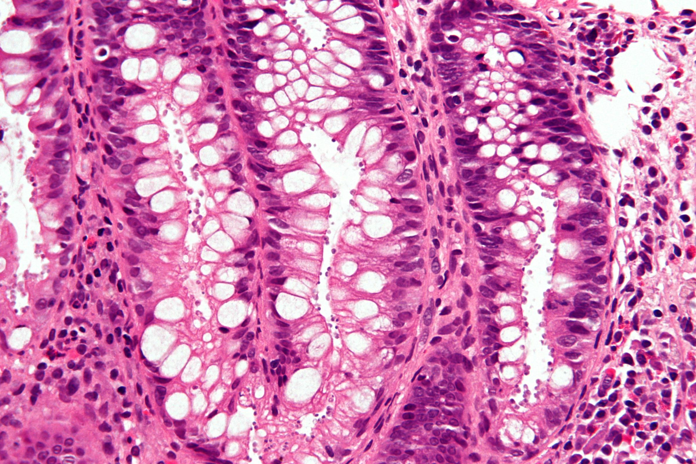 Is This Parasite Behind Your Cryptosporidiosis? (Find Out Now!) - em1f7yp