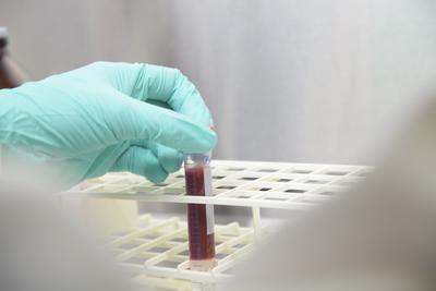 University Of Arizona Begins Statewide Antibody Testing Program