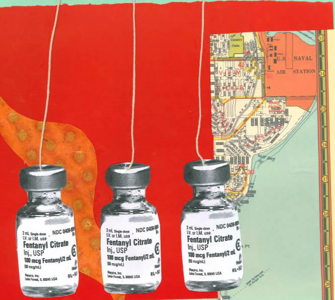 A national shortage of anesthesia and pain medications have put providers in a tough spot, including in obstetrics. Collage