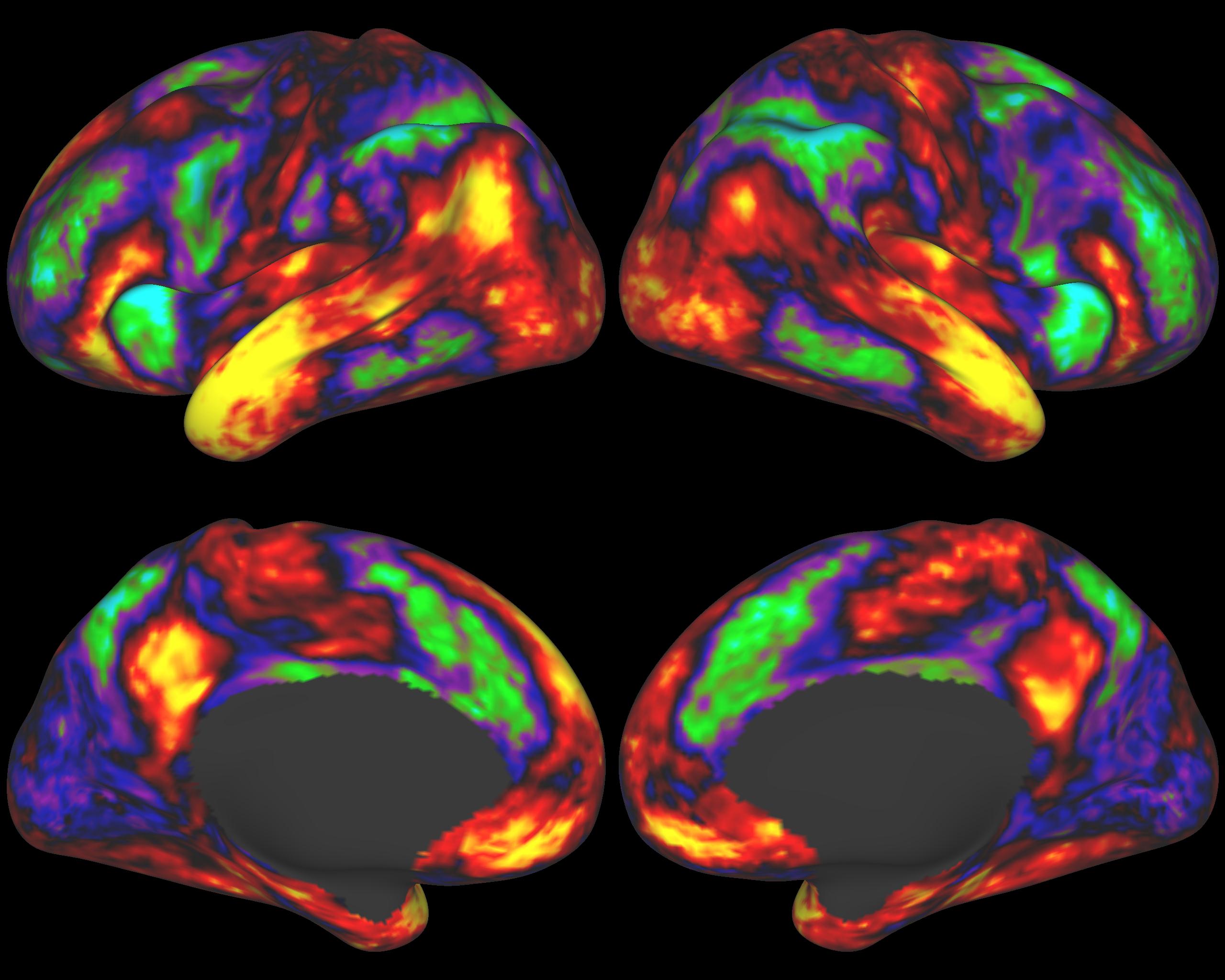 Brain карта. Коннектом мозга. Трактография головного мозга. Проект коннектом. ФМРТ И искусство.