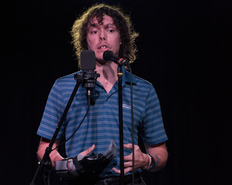 andrew oberle, a chimp attack survivor who helped create a