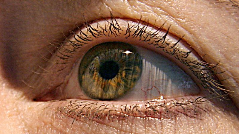 doctors-stumped-by-rare-eye-cancer-cases-in-north-carolina-alabama-wsiu