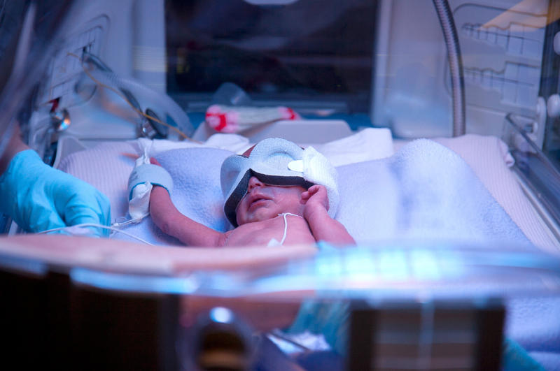 Weak Brain Connections May Link Premature Birth And Later Disorders WGLT