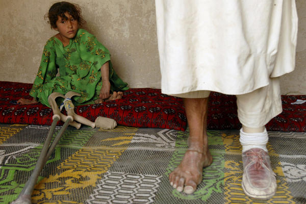 Abdul Malak, who lost his leg in a mine blast during grazing, stands on a prosthetic limb — with his daughter nearby — in a Parwan province village north of Kabul, 2008.