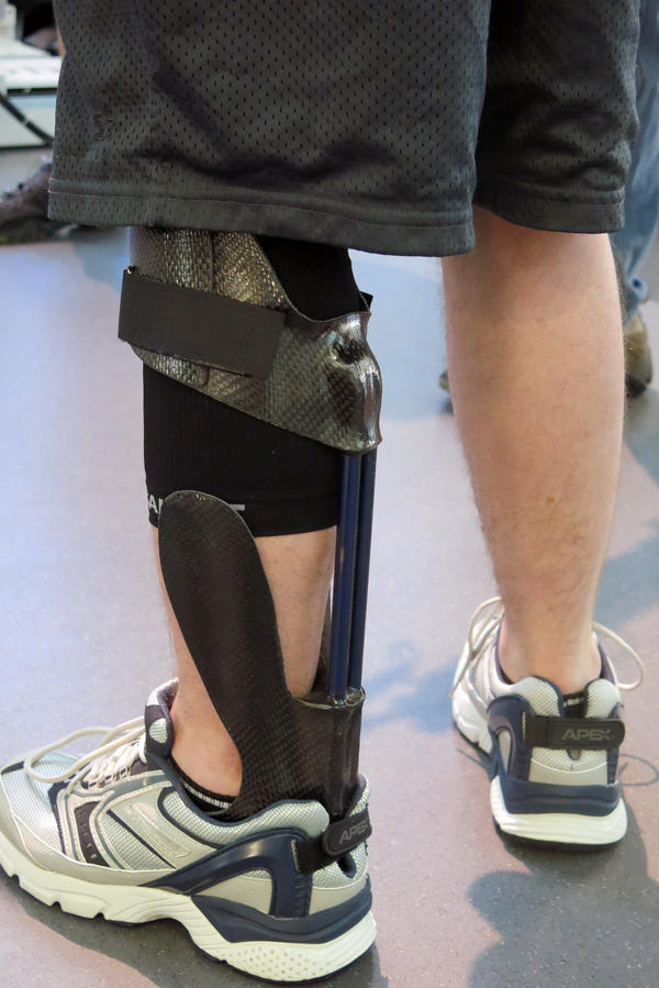 Orthotic Brace Takes Soldiers From Limping To Leaping WVXU