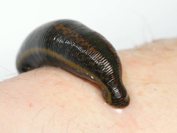 WATCH: See How Leeches Can Be A Surgeon's Sidekick | WUNC