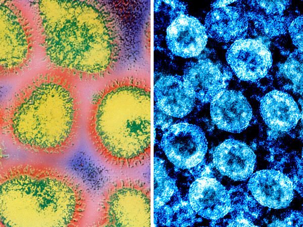 (At left) A colorized electron micrograph image of the influenza virus. (At right) Color-enhanced electron micrograph image of SARS-CoV-2 virus particles, isolated from a patient.