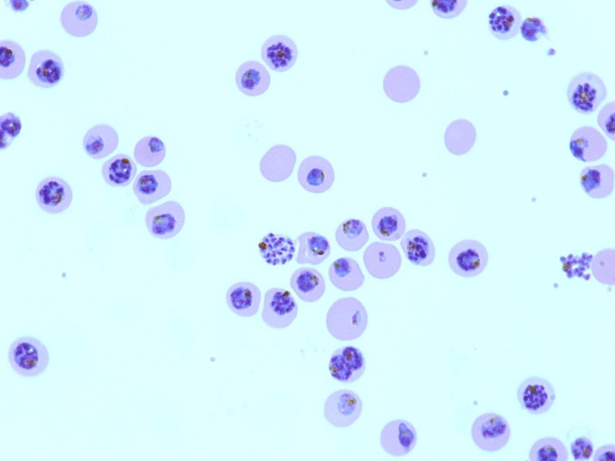 Кровь на малярию. Плазмодий Vivax. Малярийный плазмодий. Малярийный плазмодий препарат. Малярийный плазмодий микроскопия.