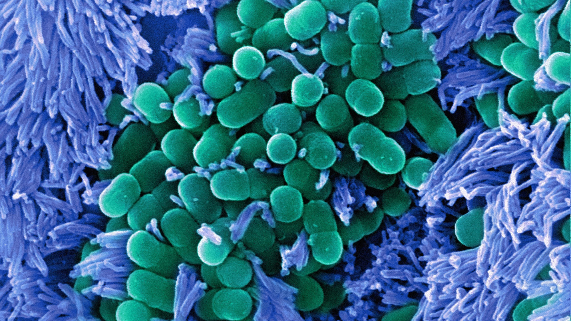 How The Microbes Inside Us Went From Enemies To Purported Superhealers