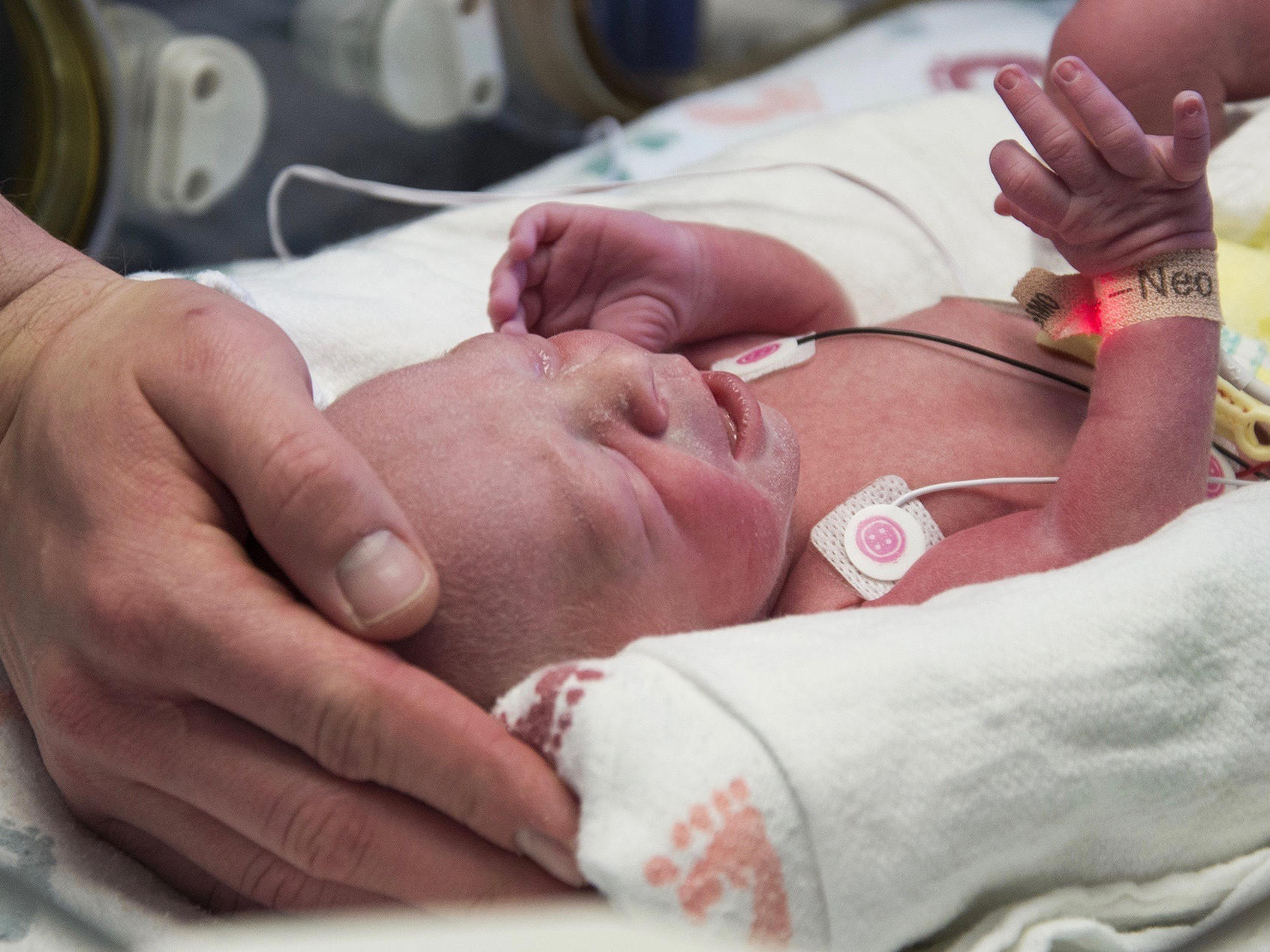 Baby Born Early Development: Understanding Your Preemie’s Growth
