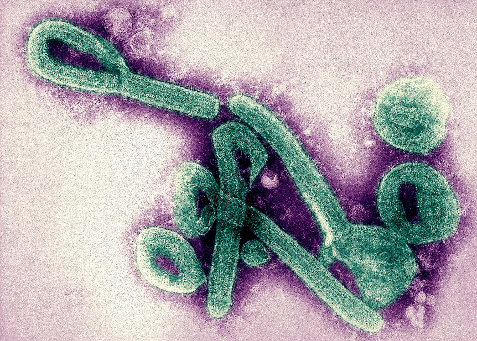 Mysterious Hemorrhagic Fever Outbreak Stumps Disease Detectives 
