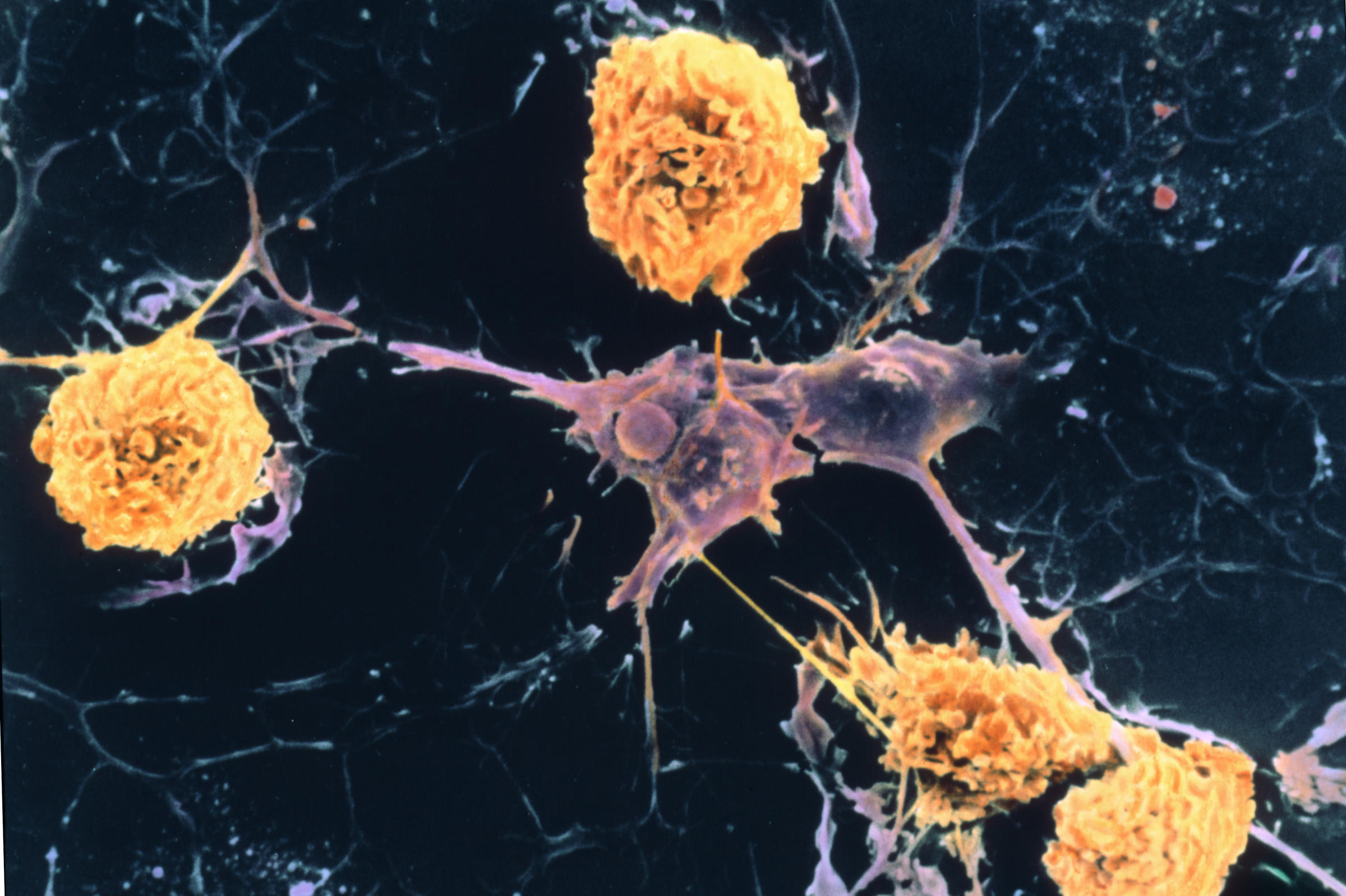 a scanning electron micrograph shows microglial cells (yellow)