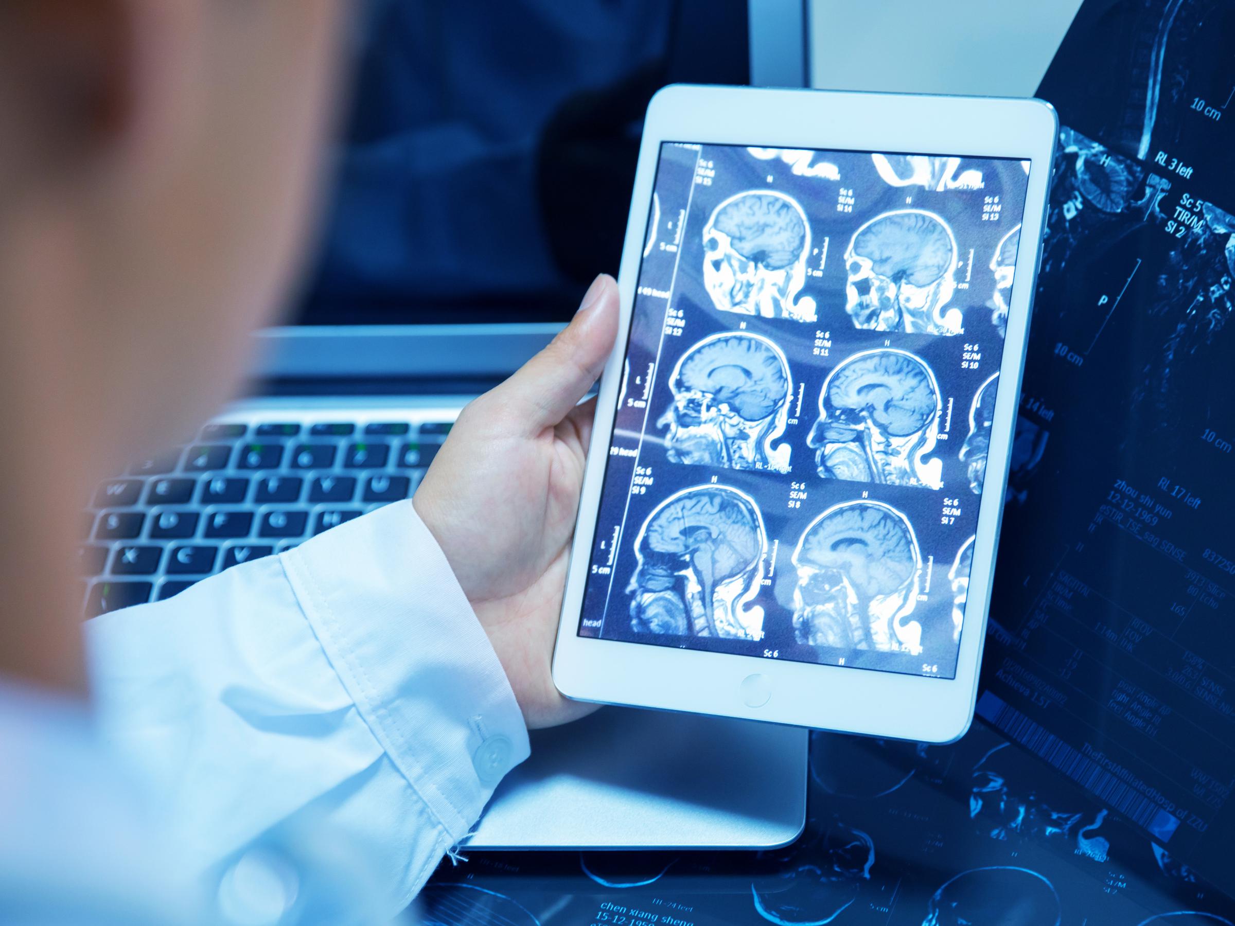 scanning-the-future-radiologists-see-their-jobs-at-risk-health-news