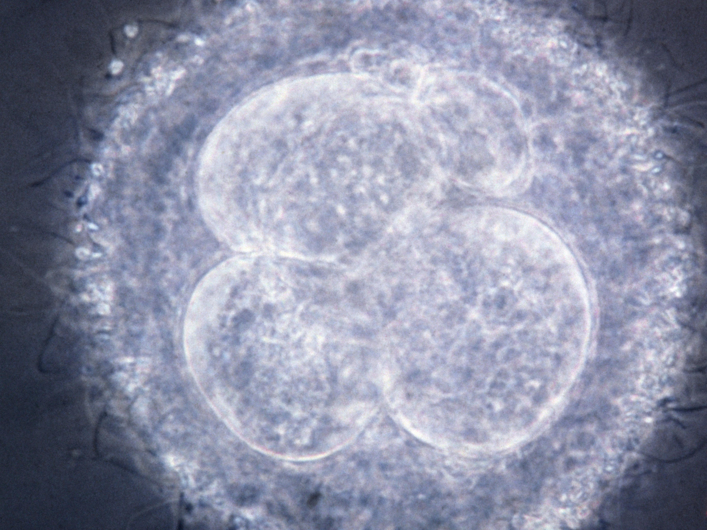 Embryo Research To Reduce Need For In Vitro Fertilization Raises ...