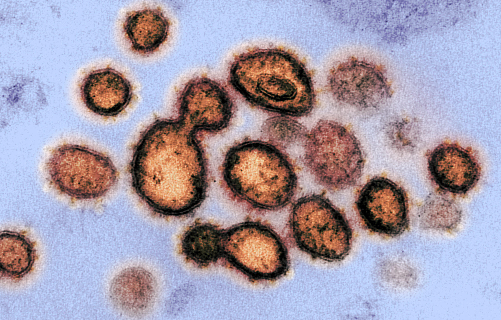 Coronavirus 101: What We Do — And Don't — Know About The ...
