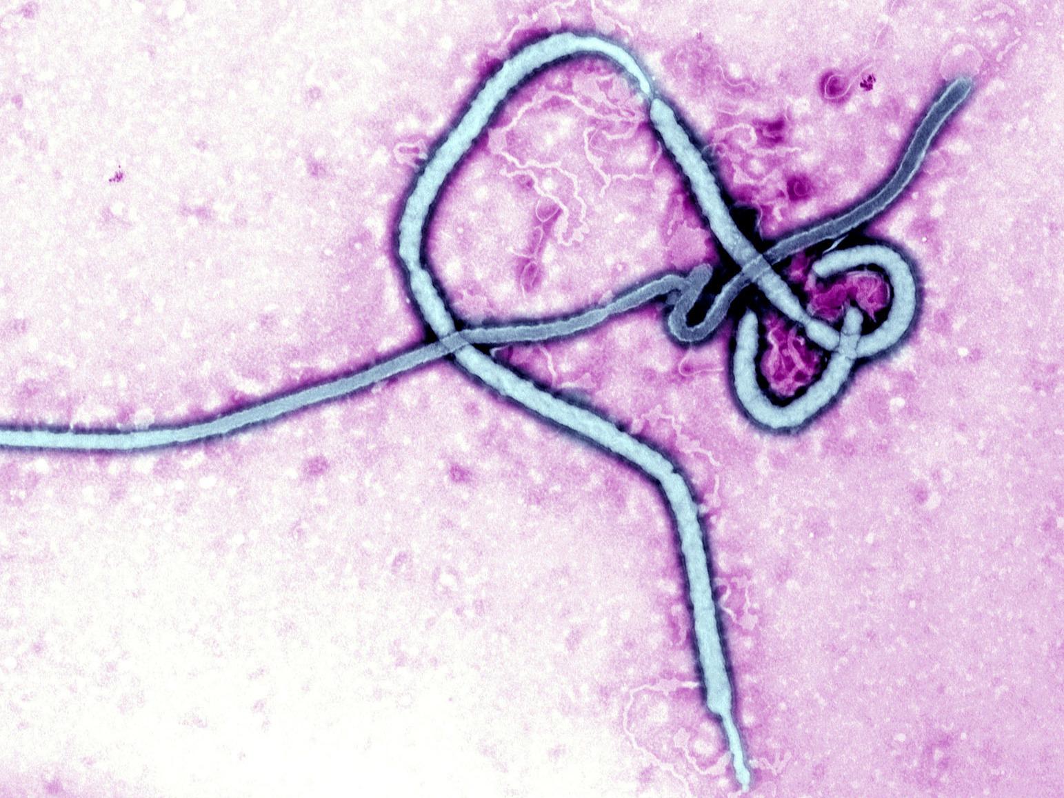 ebola giant microbe