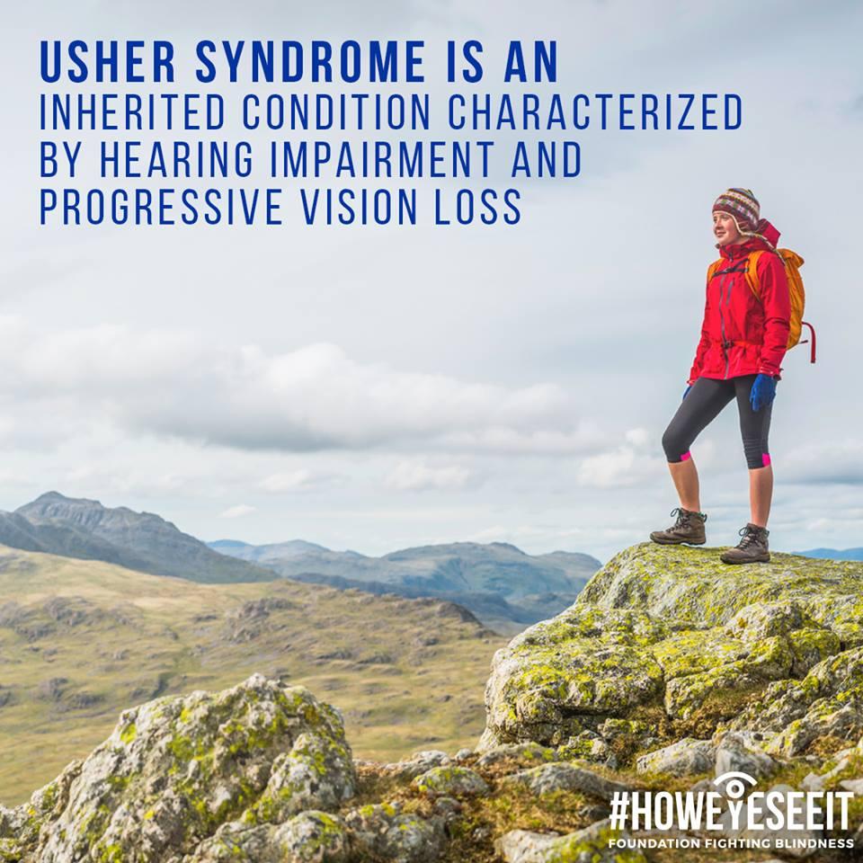 usher syndrome